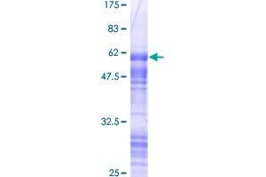 Image no. 1 for Cone-Rod Homeobox (CRX) (AA 1-299) protein (GST tag) (ABIN1350411)