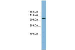 WB Suggested Anti-C14orf104 Antibody Titration: 0. (DNAAF2 antibody  (N-Term))