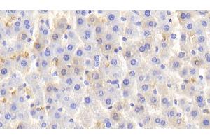 Detection of HB in Rat Liver Tissue using Polyclonal Antibody to Hemoglobin (HB) (Hemoglobin antibody)