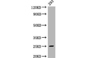 Western Blot Positive WB detected in: 293 whole cell lysate All lanes: Mad2L2 antibody at 1:2000 Secondary Goat polyclonal to rabbit IgG at 1/50000 dilution Predicted band size: 25 kDa Observed band size: 25 kDa (Recombinant MAD2L2 antibody)