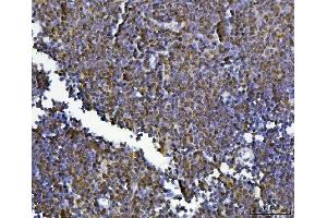 IHC analysis of KLF13 using anti-KLF13 antibody (ABIN7602036). (KLF13 antibody  (AA 56-260))