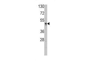 HAT1 antibody  (N-Term)