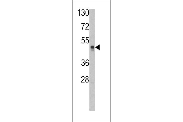 HAT1 antibody  (N-Term)