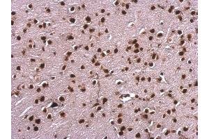 IHC-P Image Scaffold attachment factor B1 antibody detects Scaffold attachment factor B1 protein at nucleus on mouse fore brain by immunohistochemical analysis. (SAFB antibody)