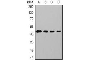 Western blot analysis of GAP43 expression in Hela (A), 293T (B), mouse brain (C), rat brain (D) whole cell lysates. (GAP43 antibody)