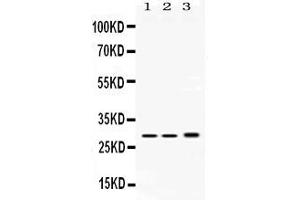 Western blot analysis of PSMA1 expression in rat testis extract ( Lane 1), mouse spleen extract ( Lane 2) and HEPG2 whole cell lysates ( Lane 3). (PSMA1 antibody  (C-Term))