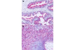 Immunohistochemical staining of formalin-fixed paraffin-embedded human prostate (A) and human spleen (B) with GPR63 polyclonal antibody . (GPR63 antibody  (Cytoplasmic Domain))
