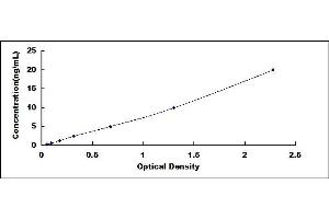 Typical standard curve (TYMS ELISA Kit)