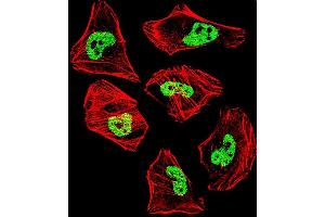 Fluorescent confocal image of Hela cell stained with TARDBP Antibody (N-term) (ABIN657685 and ABIN2846677).
