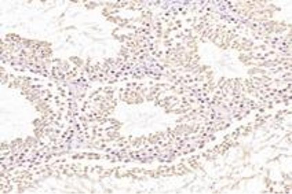 NXF2 antibody