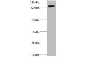 Western blot All lanes: SEMA4C antibody at 10 μg/mL + k562 whole cell lysate Secondary Goat polyclonal to rabbit IgG at 1/10000 dilution Predicted band size: 93 kDa Observed band size: 93 kDa (SEMA4C antibody  (AA 749-833))
