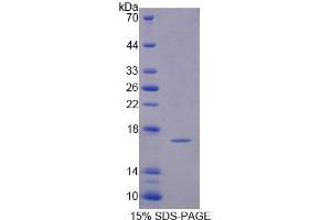 Image no. 1 for Profilin 4 (PFN4) (AA 1-125) protein (His tag) (ABIN5665242)