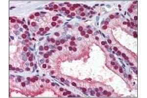 Immunohistochemistry (IHC) image for anti-Cellular Retinoic Acid Binding Protein 1 (CRABP1) (AA 1-137), (N-Term) antibody (ABIN400871) (CRABP1 antibody  (N-Term))