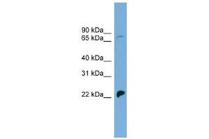 SLC5A5 antibody used at 1 ug/ml to detect target protein. (SLC5A5 antibody)