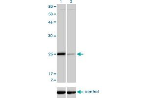 Western blot analysis of TNNI3 over-expressed 293 cell line, cotransfected with TNNI3 Validated Chimera RNAi (Lane 2) or non-transfected control (Lane 1).