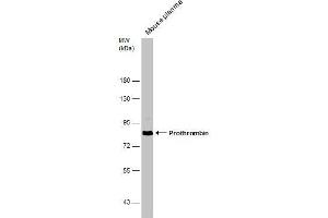WB Image Mouse tissue extract (50 μg) was separated by 7. (Prothrombin antibody  (N-Term))