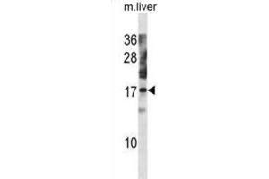 Western Blotting (WB) image for anti-NTF2-Related Export Protein 1 (NXT1) antibody (ABIN3001119) (NXT1 antibody)