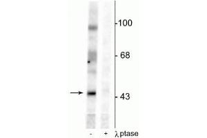 Western blot of rat testes lysate showing specific immunolabeling of the ~46 kDa EphrinB phosphorylated at Tyr331 in the first lane (-). (EPH Receptor B2 antibody  (pTyr331))
