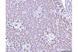 IHC analysis of PAP/ACP3 using anti-PAP/ACP3 antibody (ABIN7600122).