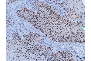 IHC analysis of YY1 using anti-YY1 antibody (ABIN7602999). (YY1 antibody  (Middle Region))