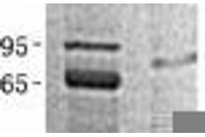 Validation with Western Blot (PPIE Protein (Transcript Variant 1) (His tag))