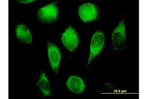 Immunofluorescence of purified MaxPab antibody to CYB5R3 on HeLa cell. (CYB5R3 antibody  (AA 1-301))
