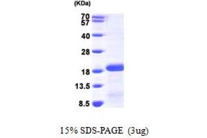 SDS-PAGE (SDS) image for P53 and DNA-Damage Regulated 1 (PDRG1) (AA 1-133) protein (His tag) (ABIN667266)