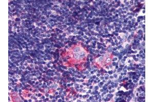 Immunohistochemical staining of Thymus using anti- P2RY5 antibody ABIN122464