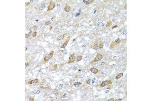 Immunohistochemistry of paraffin-embedded rat brain using HSPA6 antibody. (HSPA6 antibody  (AA 474-643))