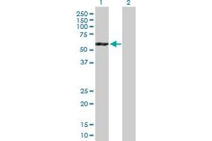 Western Blot analysis of ATP6V1B2 expression in transfected 293T cell line by ATP6V1B2 MaxPab polyclonal antibody. (ATP6V1B2 antibody  (AA 1-511))