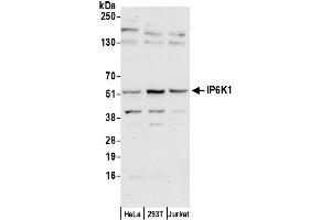 anti-Inositol Hexakisphosphate Kinase 1 (IP6K1) (AA 75-125) antibody