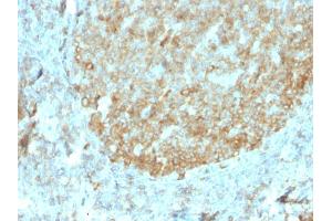 Formalin-fixed, paraffin-embedded human Tonsil stained with MALT1 Recombinant Mouse Monoclonal Antibody (rMT1/410). (Recombinant MALT1 antibody  (AA 701-808))
