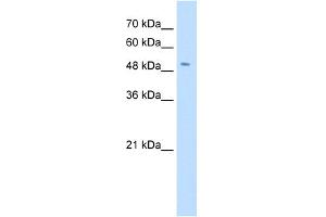 Western Blotting (WB) image for anti-Solute Carrier Family 18 (Vesicular Monoamine Transporter), Member 2 (SLC18A2) (N-Term) antibody (ABIN2781588)