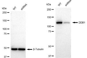 Western blotting analysis using DDB1 antibody (ABIN7798273). (Recombinant DDB1 antibody)