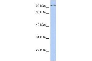 TRPC4AP antibody used at 1 ug/ml to detect target protein. (TRPC4AP antibody  (Middle Region))