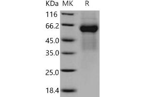 FGFRL1 Protein (His tag)