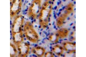 Used in DAB staining on fromalin fixed paraffin-embedded Kidney tissue (Latexin antibody  (AA 1-222))