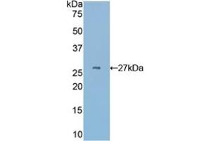 Detection of Recombinant CYR61, Mouse using Polyclonal Antibody to Cysteine Rich Protein, Angiogenic Inducer 61 (CYR61) (CYR61 antibody  (AA 176-379))