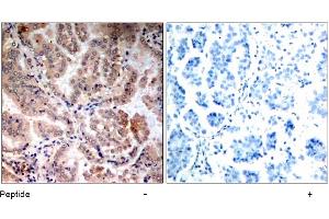 Image no. 1 for anti-Protein Kinase, AMP-Activated, alpha 1 Catalytic Subunit (PRKAA1) (Thr174) antibody (ABIN197410) (PRKAA1 antibody  (Thr174))