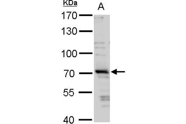 TRIM32 antibody