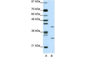 WB Suggested Anti-ZFP36L1 Antibody Titration: 1. (ZFP36L1 antibody  (N-Term))