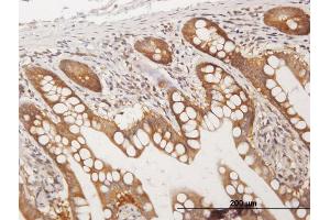 Immunostaining (ISt) image for anti-Coiled-Coil and C2 Domain Containing 1A (CC2D1A) (AA 1-951) antibody (ABIN527223)