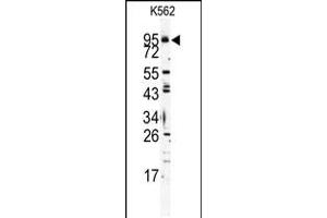 Western blot analysis of Mouse TLR6 Antibody in K562 cell line lysates (35ug/lane) (TLR6 antibody  (C-Term))