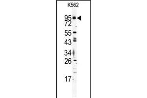 Western blot analysis of Mouse TLR6 Antibody in K562 cell line lysates (35ug/lane)