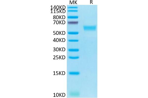 FAS Protein (AA 26-173) (Fc Tag)