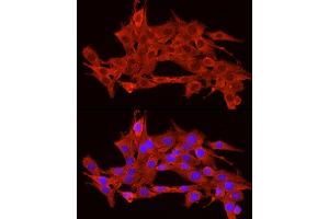 Immunofluorescence analysis of PC-12 cells using POMC Rabbit pAb (ABIN3017230, ABIN3017231, ABIN3017232 and ABIN6220004) at dilution of 1:200 (40x lens). (POMC antibody  (AA 1-267))