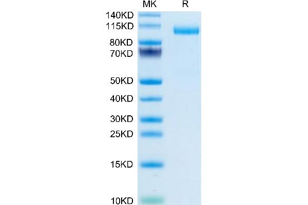 Thyroperoxidase Protein (AA 32-834) (His tag)