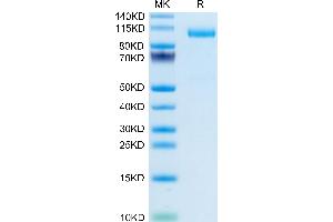 Mouse TPO/Thyroid Peroxidase on Tris-Bis PAGE under reduced condition. (Thyroperoxidase Protein (AA 32-834) (His tag))