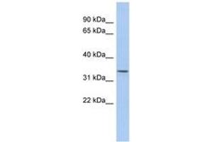 Image no. 1 for anti-Zinc Finger, DHHC-Type Containing 24 (ZDHHC24) (AA 35-84) antibody (ABIN6743942) (ZDHHC24 antibody  (AA 35-84))