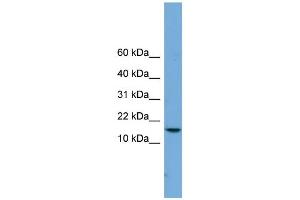 WB Suggested Anti-PAGE4 Antibody Titration:  0. (PAGE4 antibody  (Middle Region))